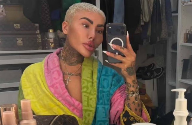 Read more about the article The Lip King Cause of Death, Obituary: Reality TV Star ‘The Lip King’ Jordan James Parke Found Dead in London